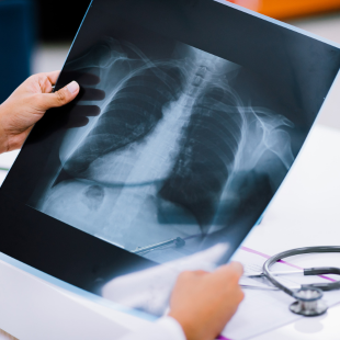 Técnico em Radiologia